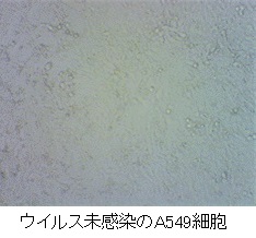 ウイルス未感染のA549細胞