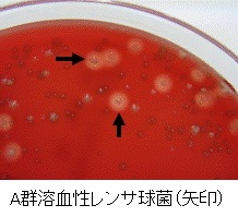 細菌の分離